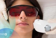 بهترین مرکز لیزر مو نیاوران