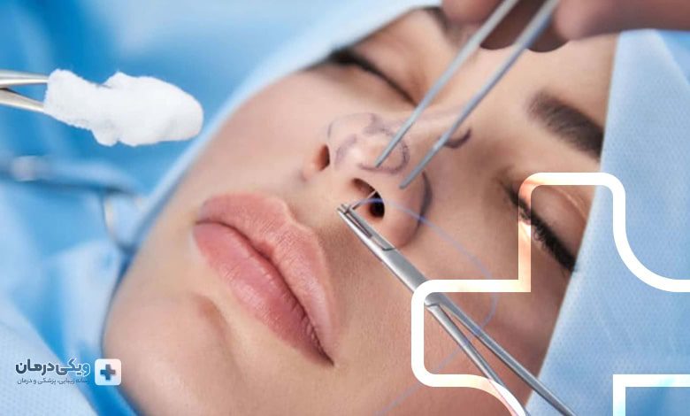 مهمترین مراقبت های بعد از عمل بینی