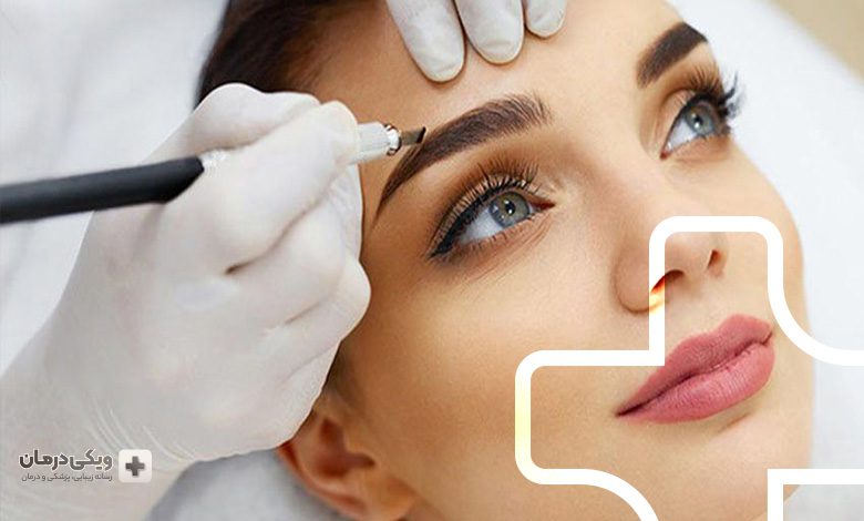 میکروپیگمنتیشن چیست