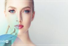 بهترین کلینیک زیبایی در الهیه