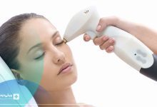 بهترین مرکز لیزر مو یوسف آباد