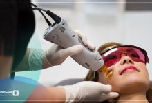 بهترین مرکز لیزر مو پرند