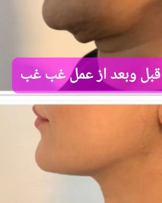 نمونه کار دکتر گنجه