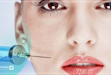 بهتریمن کلینیک زیبایی در صادقیه