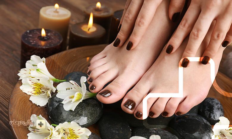 روش های پیشگیری از پینه پا