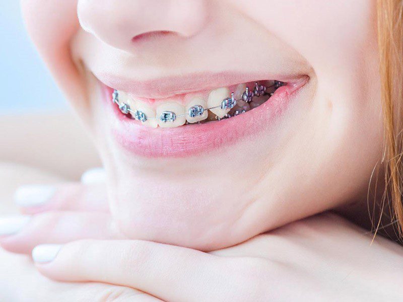 دکتر درویش پور دندانپزشک