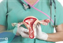 جراحی پرینورافی