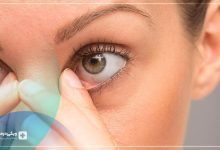 علائم خشکی چشم