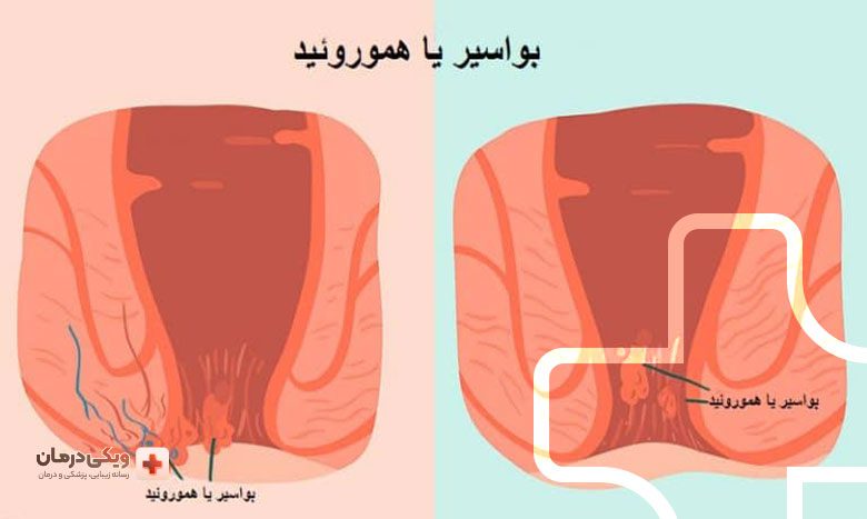 درمانهای خانگی