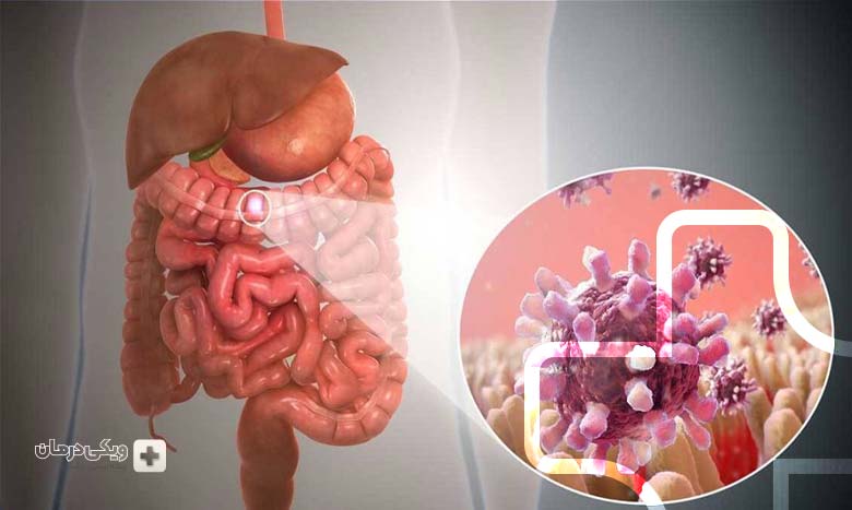 دلایل وجود خون در مدفوع چیست؟