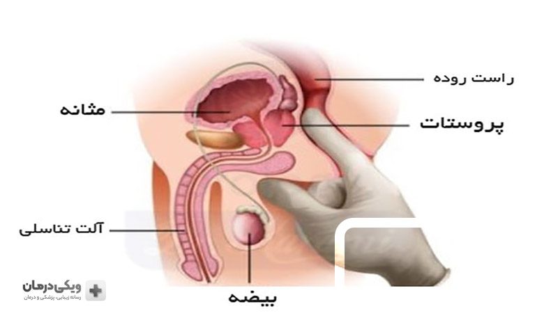 آزمایشات سرطان پروستات