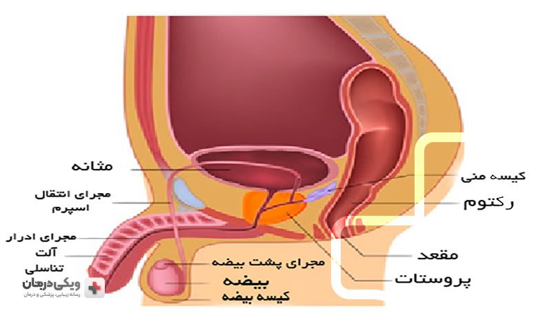 انواع سرطان پروستات