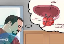 پروستات