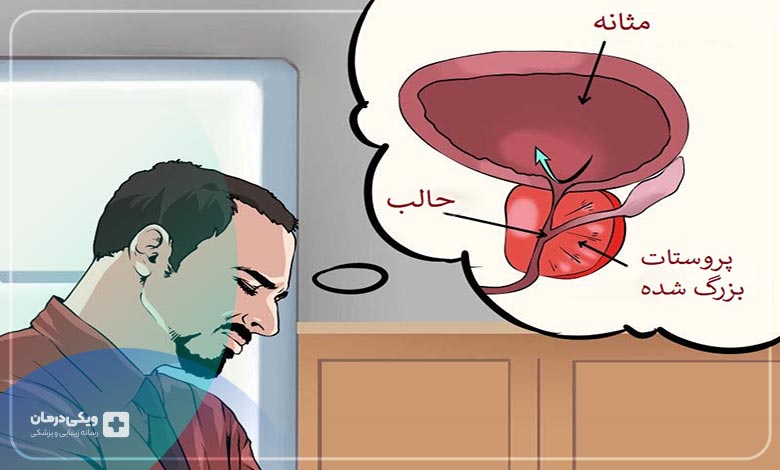 پروستات