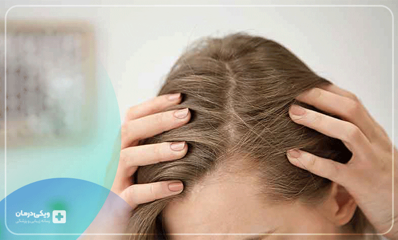 راههای پیشگیری از موخوره