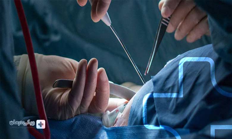روش های درمانی پرده الت توسط بهترین دکتر پرده آلت 