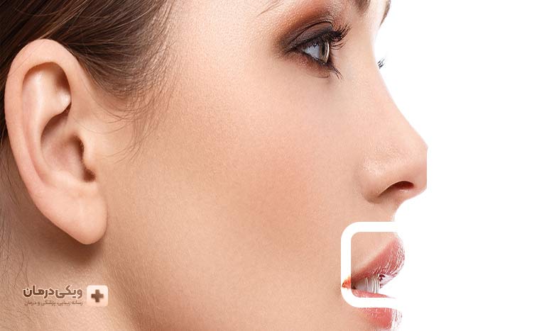 مزایای لیفت بینی