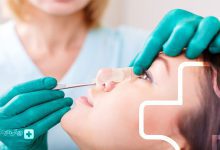 بهترین جراح بینی گوشتی در تهران