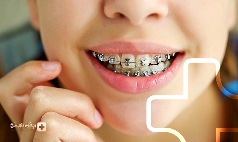بهترین متخصص ارتودنسی دندان کیست؟