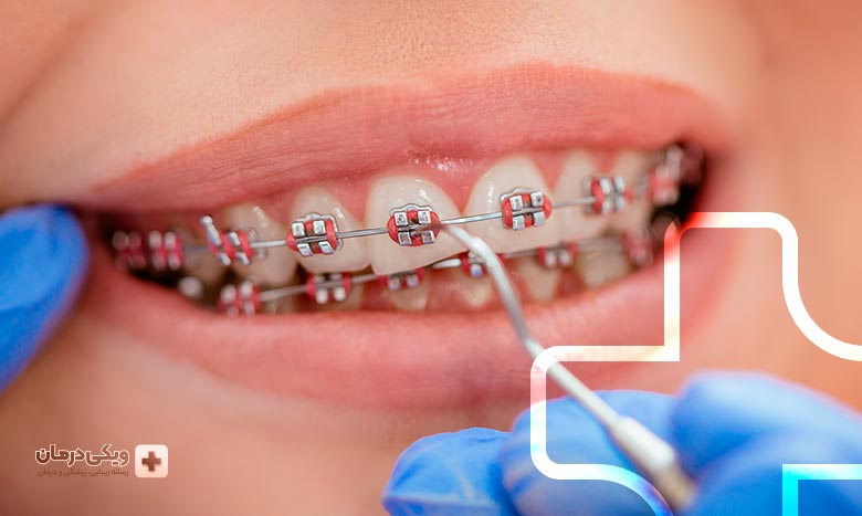 خدمات درمانی متخصص ارتودنسی چیست؟