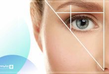 بهترین دکتر بلفاروپلاستی در ارومیه