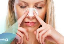 روش بسته در عمل بینی