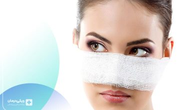علل ورم کردن بینی بعد از عمل