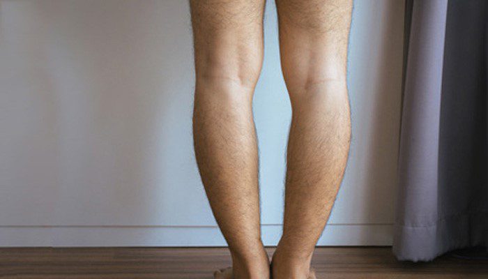 دلایل ایجاد پای پرانتزی