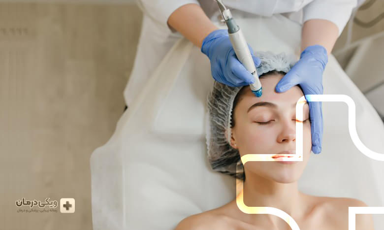 فیشیال میکرودرم ابریژن