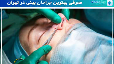 بهترین جراح بینی در تهران