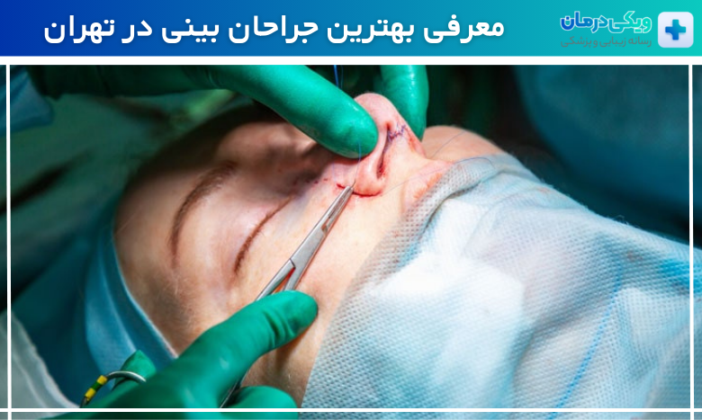 بهترین جراح بینی در تهران