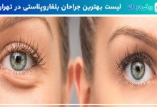 بهترین جراح بلفاروپلاستی در تهران