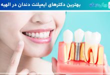 بهترین دکتر ایمپلنت دندان در الهیه