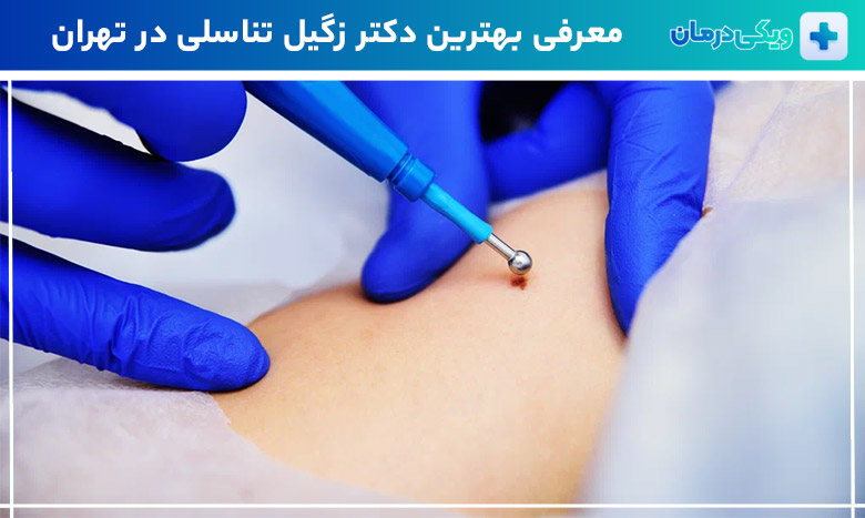 بهترین دکتر زگیل تناسلی در تهران