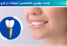 بهترین متخصص ایمپلنت در کرج