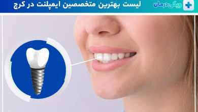 بهترین متخصص ایمپلنت در کرج