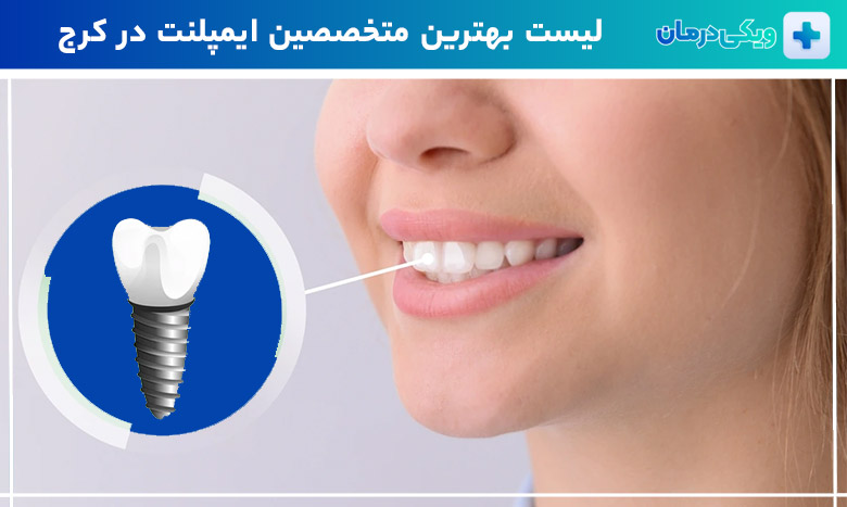 بهترین متخصص ایمپلنت در کرج