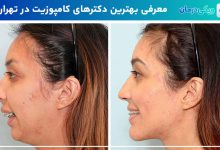 بهترین جراح فک و صورت در تهران
