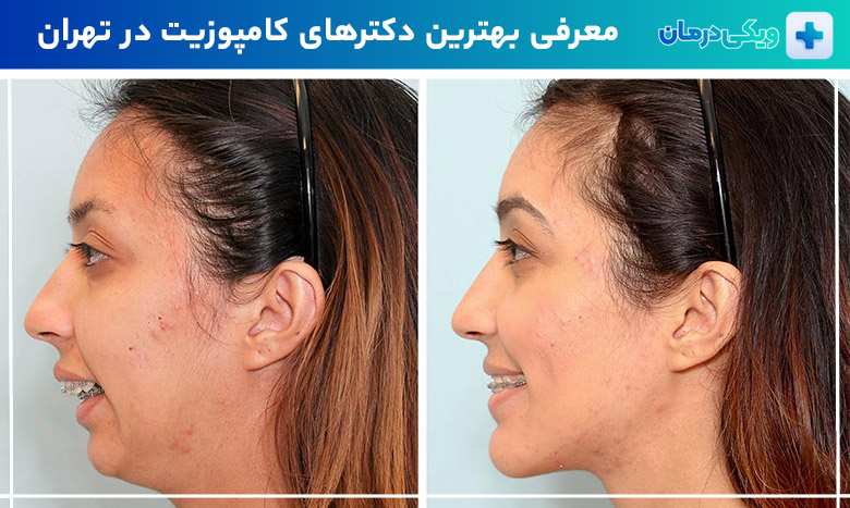 بهترین جراح فک و صورت در تهران