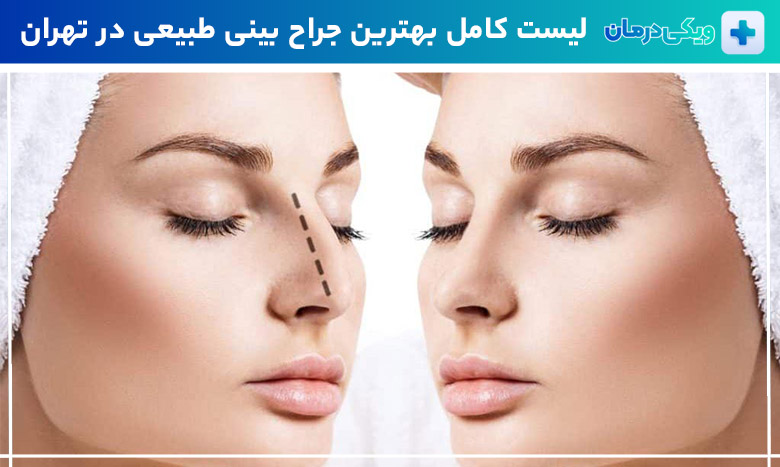 بهترین جراح بینی طبیعی در تهران