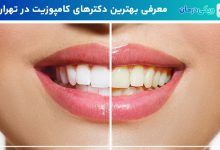 بهترین دکترهای کامپوزیت دندان در تهران