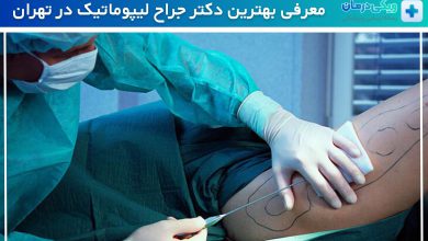 بهترین دکتر جراح لیپوماتیک در تهران