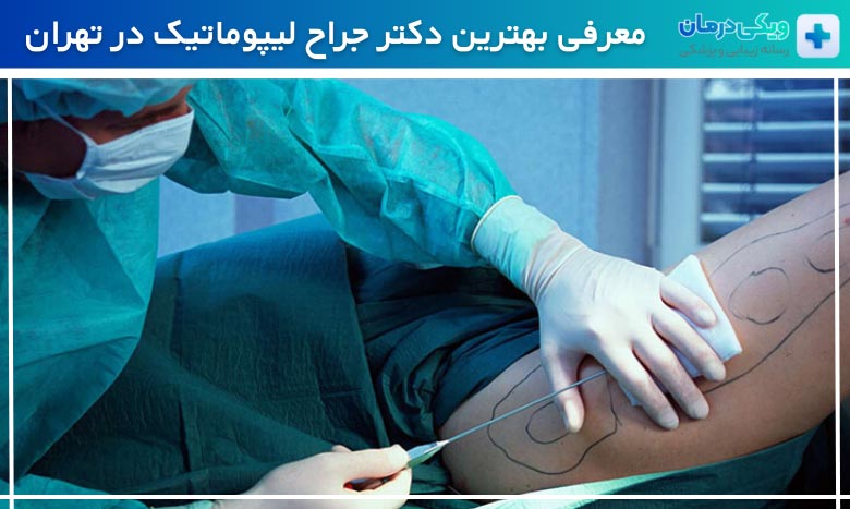 بهترین دکتر جراح لیپوماتیک در تهران