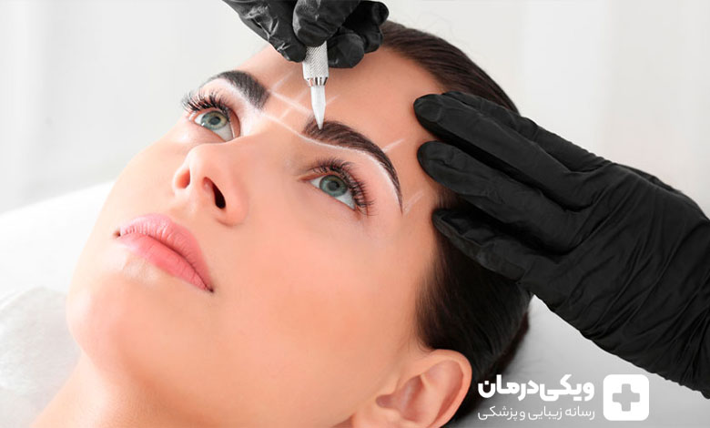 بهترین دکتر کاشت ابرو در تهران