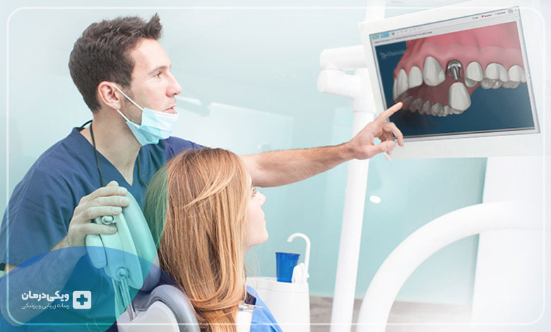 بهترین متخصص ایمپلنت در شرق تهران