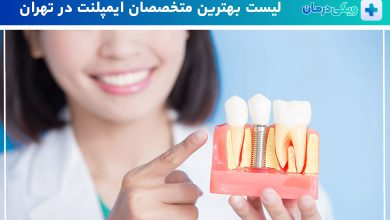 بهترین دکتر متخصص ایمپلنت در تهران