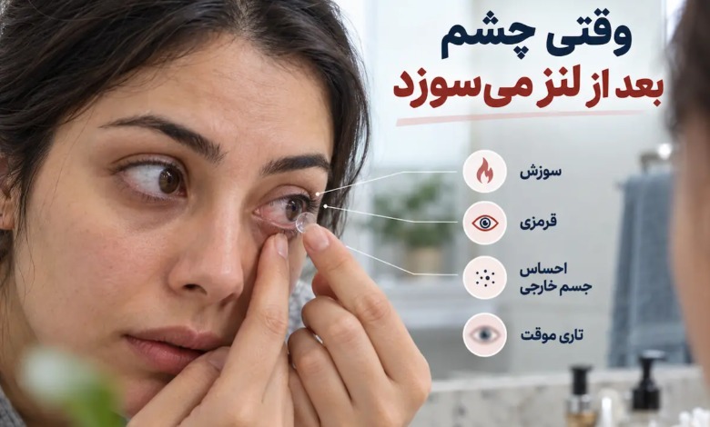 سوزش و قرمزی چشم بعد از گذاشتن لنز تماسی و نشانه های هشداردهنده