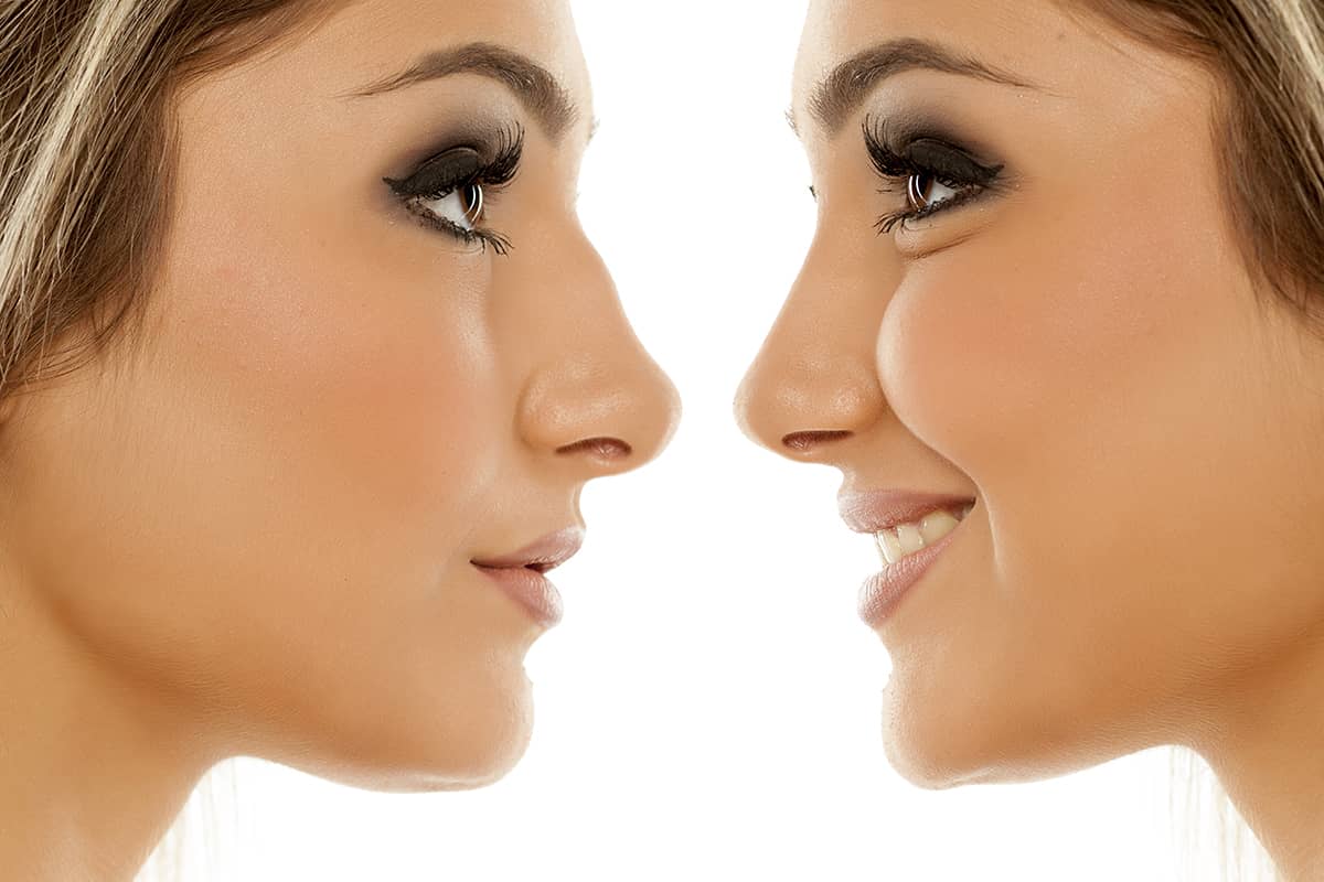 هزینه جراحی بینی به چه عواملی بستگی دارد؟